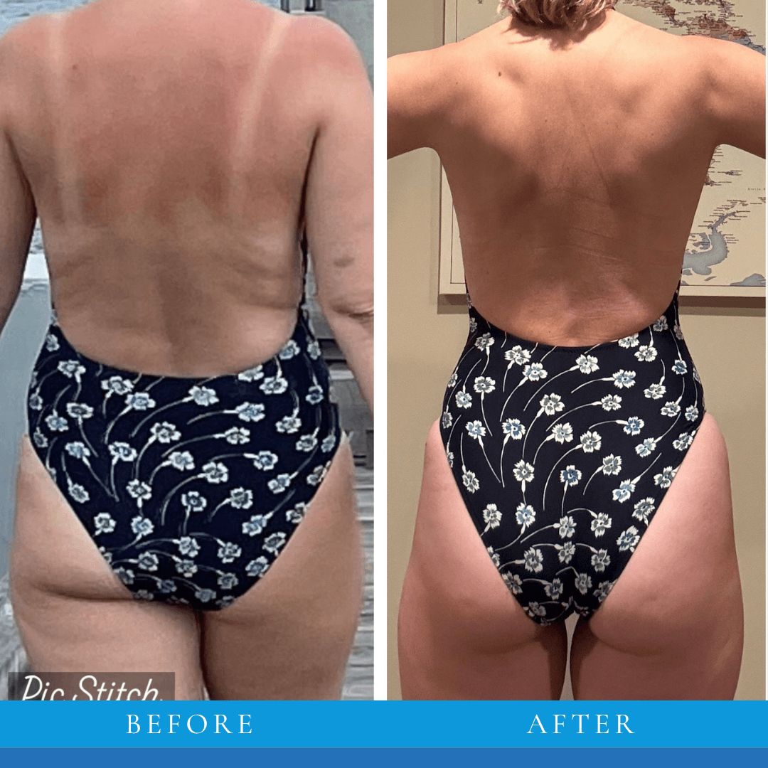 Sam transformation