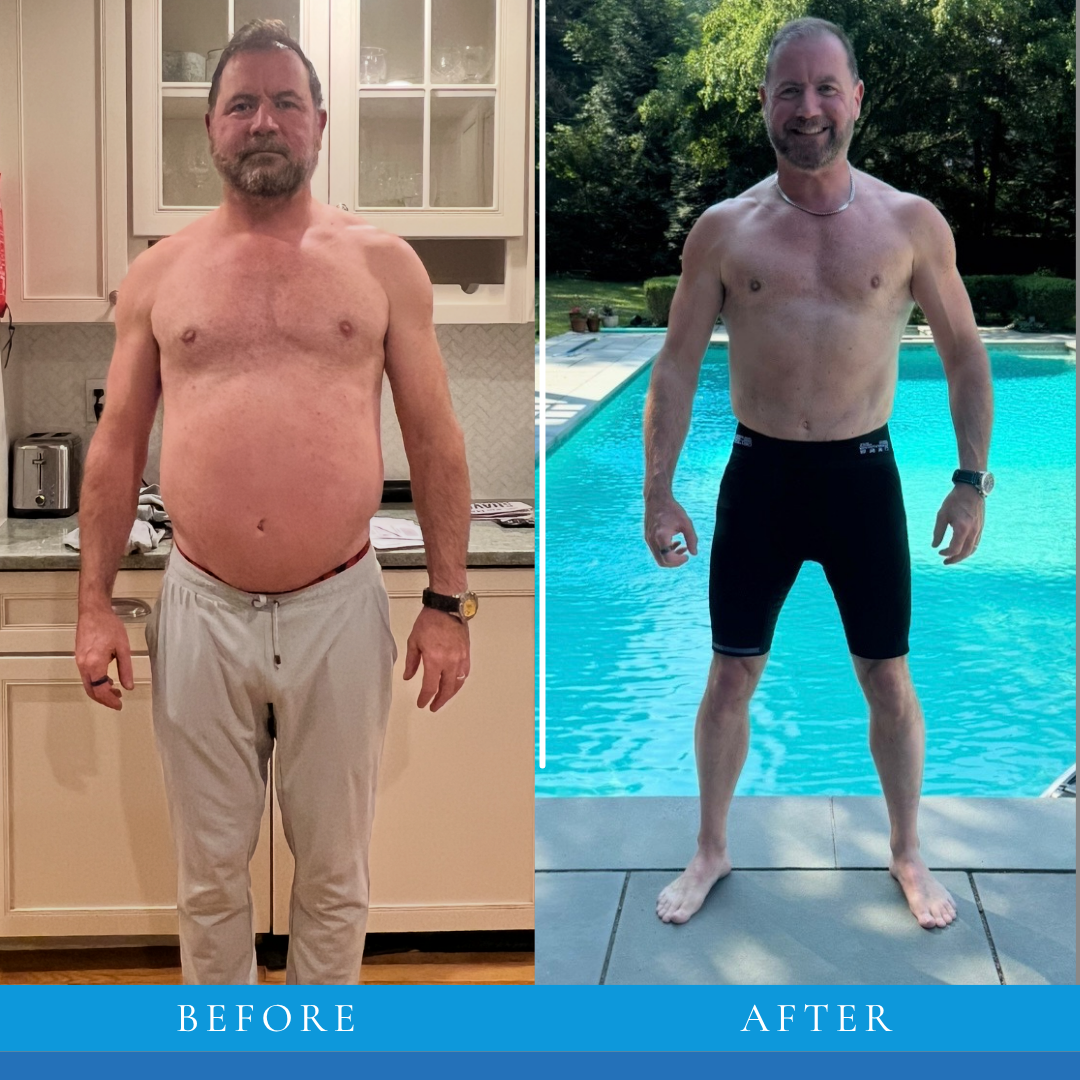 Kieron transformation