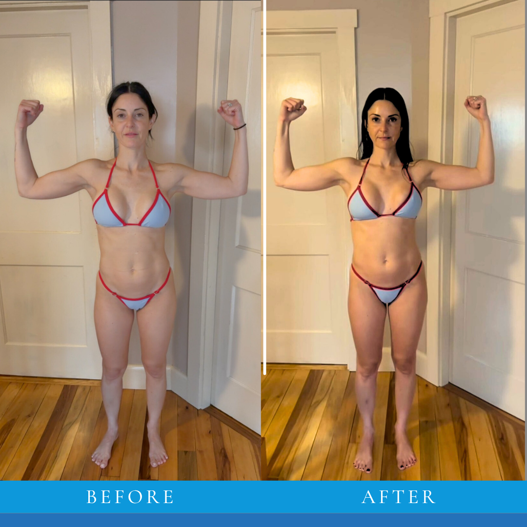 Lauren transformation